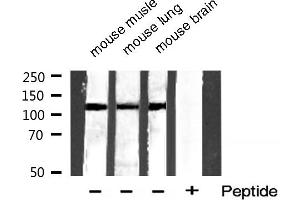 Western blot analysis of extracts of various smaple,using Phospho-HDAC5 (Ser259) Antibody. (HDAC5 抗体  (pSer259))