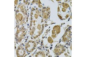 Immunohistochemistry of paraffin-embedded human stomach using CCNA2 antibody.