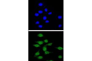Confocal immunofluorescent analysis of AIRE Antibody (Center) with 293 cell followed by Alexa Fluor® 488-conjugated goat anti-rabbit lgG (green). (AIRE 抗体  (Middle Region))