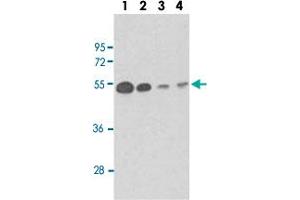 Western blot analysis of Lane 1: mouse brain tissue lysates Lane 2: Y79 whole cell lysates Lane 3: CEM whole cell lysates Lane 4: 293 whole cell lysates reacted with TUBB1 monoclonal antibody  at 1:100-1:500 dilution.