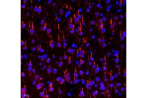 Immunofluorescent analysis of paraformaldehyde-fixed rat brain using TRIM46 (ABIN7076020) at dilution of 1: 3200 (TRIM46 抗体)
