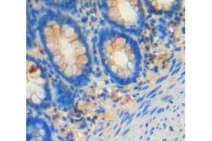 Used in DAB staining on fromalin fixed paraffin-embedded rectum tissue (FES 抗体  (AA 509-766))