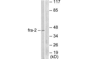 Western blot analysis of extracts from LOVO cells, using Fra-2 antibody (ABIN5976401). (FOSL2 抗体  (C-Term))