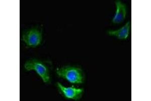 Immunofluorescent analysis of A549 cells using ABIN7172144 at dilution of 1:100 and Alexa Fluor 488-congugated AffiniPure Goat Anti-Rabbit IgG(H+L) (THADA 抗体  (AA 432-651))