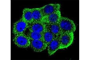 Confocal immunofluorescent analysis of Hamartin antibody with HeLa cells followed by Alexa Fluor 488-conjugated goat anti-rabbit lgG (green). (TSC1 抗体  (AA 401-430))