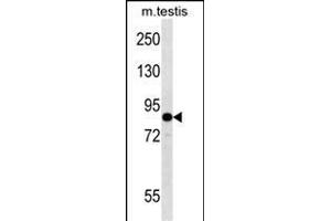 EIF2B5 Antibody (N-term) (ABIN657014 and ABIN2846194) western blot analysis in mouse testis tissue lysates (35 μg/lane). (EIF2B5 抗体  (N-Term))