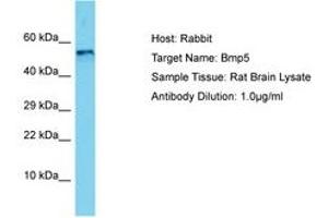 Image no. 1 for anti-Bone Morphogenetic Protein 5 (BMP5) (AA 327-376) antibody (ABIN6750503) (BMP5 抗体  (AA 327-376))