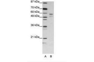 Image no. 1 for anti-Serine--tRNA Ligase, Cytoplasmic-Like (C-Term) antibody (ABIN202697) (Serine--tRNA Ligase, Cytoplasmic-Like (C-Term) 抗体)