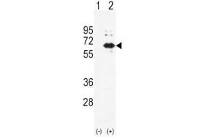 Western blot analysis of Alkaline Phosphatase antibody and 293 cell lysate (2 ug/lane) either nontransfected (Lane 1) or transiently transfected (2) with the ALPL gene. (ALPL 抗体  (AA 217-246))