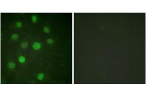 Immunofluorescence analysis of HuvEc cells, using Histone H1 (Ab-17) Antibody. (Histone H1 抗体  (AA 1-50))