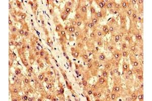 Immunohistochemistry (IHC) image for anti-Potassium Inwardly-Rectifying Channel, Subfamily J, Member 11 (KCNJ11) (AA 172-390) antibody (ABIN7145021)