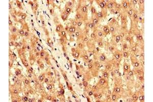 Immunohistochemistry of paraffin-embedded human liver tissue using ABIN7145021 at dilution of 1:100 (KCNJ11 抗体  (AA 172-390))