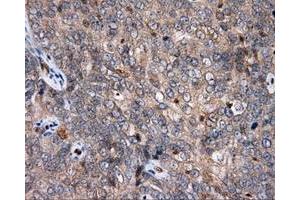 Immunohistochemical staining of paraffin-embedded Kidney tissue using anti-APP mouse monoclonal antibody. (APP 抗体)