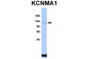 Host:  Rabbit  Target Name:  KCNMA1  Sample Type:  Jurkat  Antibody Dilution:  1. (KCNMA1 抗体  (C-Term))