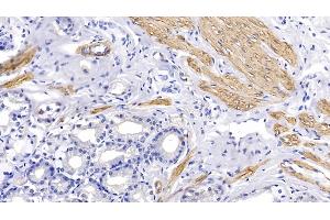 Detection of ACTC1 in Human Stomach Tissue using Monoclonal Antibody to Actin Alpha 1, Cardiac Muscle (ACTC1) (ACTC1 抗体  (AA 156-368))