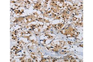 Immunohistochemistry of Human brain  using CMTM8 Polyclonal Antibody at dilution of 1:40 (CMTM8 抗体)