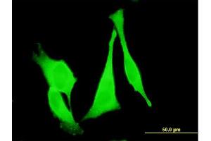 Immunofluorescence of monoclonal antibody to FZD3 on HeLa cell. (FZD3 抗体  (AA 55-157))