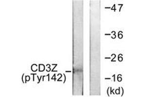 Western blot analysis of extracts from Jurkat cells treated with UV 15', using CD3 zeta (Phospho-Tyr142) Antibody. (CD247 抗体  (pTyr142))