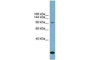 Western Blotting (WB) image for anti-Solute Carrier Family 12 (Potassium-Chloride Transporter) Member 4 (SLC12A4) (N-Term) antibody (ABIN2781617)