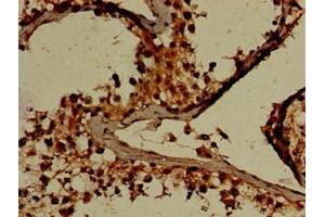 Immunohistochemistry of paraffin-embedded human testis tissue using ABIN7154194 at dilution of 1:100 (GARS 抗体  (AA 1-389))