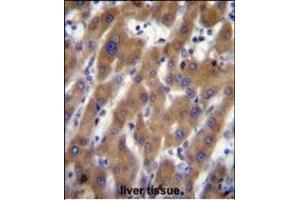 UB Antibody (N-term) (ABIN656700 and ABIN2845933) immunohistochemistry analysis in formalin fixed and paraffin embedded human liver tissue followed by peroxidase conjugation of the secondary antibody and DAB staining. (UBAP2 抗体  (N-Term))