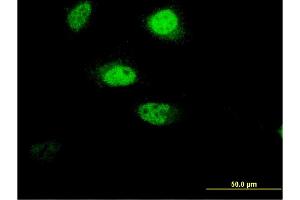 Immunofluorescence of monoclonal antibody to RNF207 on HeLa cell. (RNF207 抗体  (AA 135-244))