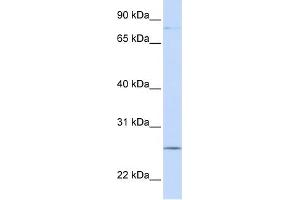 WB Suggested Anti-PCDHGC3 Antibody Titration:  0. (Protocadherin gamma Subfamily C, 3 (PCDHGC3) (N-Term) 抗体)