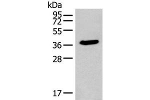 Western blot analysis of HEPG2 cell lysate using ACBD4 Polyclonal Antibody at dilution of 1:400 (ACBD4 抗体)