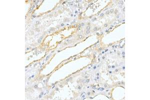 Immunohistochemistry of paraffin-embedded human kidney using Prostatic Acid Phosphatase (ACPP) Rabbit pAb (ABIN3022671, ABIN3022672, ABIN3022673 and ABIN6219082) at dilution of 1:50 (40x lens). (ACPP 抗体  (AA 40-300))