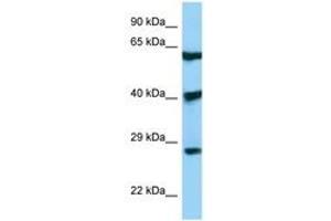 Image no. 1 for anti-DKK3 (AA 51-100) antibody (ABIN6748413) (DKK3 抗体  (AA 51-100))