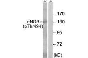 Western blot analysis of extracts from Jurkat cells, using eNOS (Phospho-Thr494) Antibody. (ENOS 抗体  (pThr495))