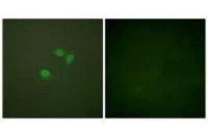 Immunofluorescence analysis of NIH/3T3 cells, using Sumo1 antibody. (SUMO1 抗体  (N-Term))