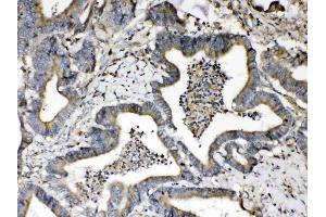 IHC analysis of Beta 2 Microglobulin using anti- Beta 2 Microglobulin antibody .