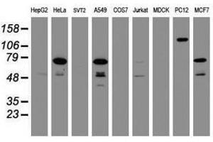 Image no. 2 for anti-Receptor (TNFRSF)-Interacting serine-threonine Kinase 1 (RIPK1) (AA 133-422) antibody (ABIN1490912) (RIPK1 抗体  (AA 133-422))