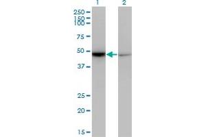Western Blot analysis of NR0B1 expression in transfected 293T cell line by NR0B1 monoclonal antibody (M07), clone 3G8.