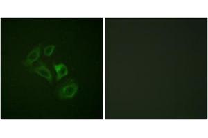 Immunofluorescence analysis of HepG2 cells, using c-Met (Phospho-Tyr1003) antibody. (c-MET 抗体  (pTyr1003))