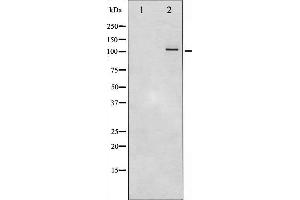 Western blot analysis of PKD1/2/3/PKC μ phosphorylation expression in PMA treated A549 whole cell lysates,The lane on the left is treated with the antigen-specific peptide. (PKD1/2/3/PKC mu (pSer738), (pSer742) 抗体)