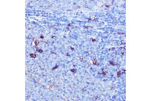 Immunohistochemistry of paraffin-embedded rat spleen using GSDMD Rabbit pAb  at dilution of 1:100 (40x lens). (GSDMD 抗体)