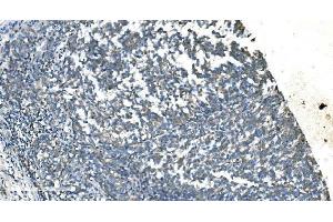 IHC analysis of TIMM8A/DDP using anti-TIMM8A/DDP antibody (ABIN7600039). (TIMM8A/DDP 抗体  (AA 14-97))