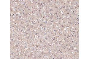 Immunohistochemistry of paraffin-embedded Rat liver using HSF1 Polyclonal Antibody at dilution of 1:100 (40x lens). (HSF1 抗体)