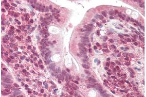 Human Small Intestine (formalin-fixed, paraffin-embedded) stained with POLL antibody ABIN337014 at 5 ug/ml followed by biotinylated anti-goat IgG secondary antibody ABIN481715, alkaline phosphatase-streptavidin and chromogen. (POLL 抗体  (AA 563-575))