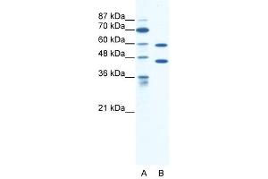 CATSPER2 antibody used at 1. (CATSPER2 抗体  (C-Term))