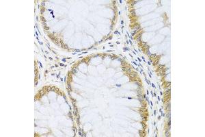 Immunohistochemistry of paraffin-embedded human colon using ARL6 antibody (ABIN5974886) at dilution of 1/100 (40x lens). (ARL6 抗体)