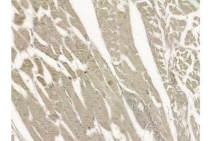 ABIN6263844 and ABIN6272715 at 1/100 staining human tongue carcinoma by IHC-P.