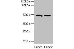 anti-SurA (AA 21-428) antibody