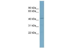 WB Suggested Anti-CSNK1D Antibody Titration: 0. (Casein Kinase 1 delta 抗体  (Middle Region))