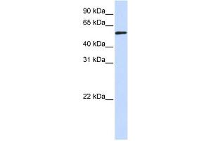 WB Suggested Anti-TADA3L Antibody Titration:  0. (TADA3L 抗体  (Middle Region))