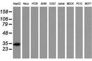 Western blot analysis of extracts (35 µg) from 9 different cell lines by using anti-SULT2A1 monoclonal antibody. (SULT2A1 抗体)