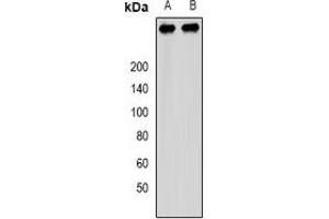 Western blot analysis of PCM1 expression in SW480 (A), 293T (B) whole cell lysates. (PCM1 抗体)