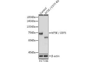 Western Blotting (WB) image for anti-5'-Nucleotidase, Ecto (CD73) (NT5E) (AA 290-550) antibody (ABIN3022734)